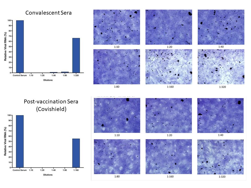 Variant indien du coronavirus: ce que l'on sait sur le “variant double mutant” Variant indien du coronavirus: ce que l'on sait sur le “variant double mutant”